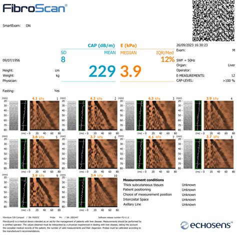 fibroscan results chart|fibroscan results explained uk.